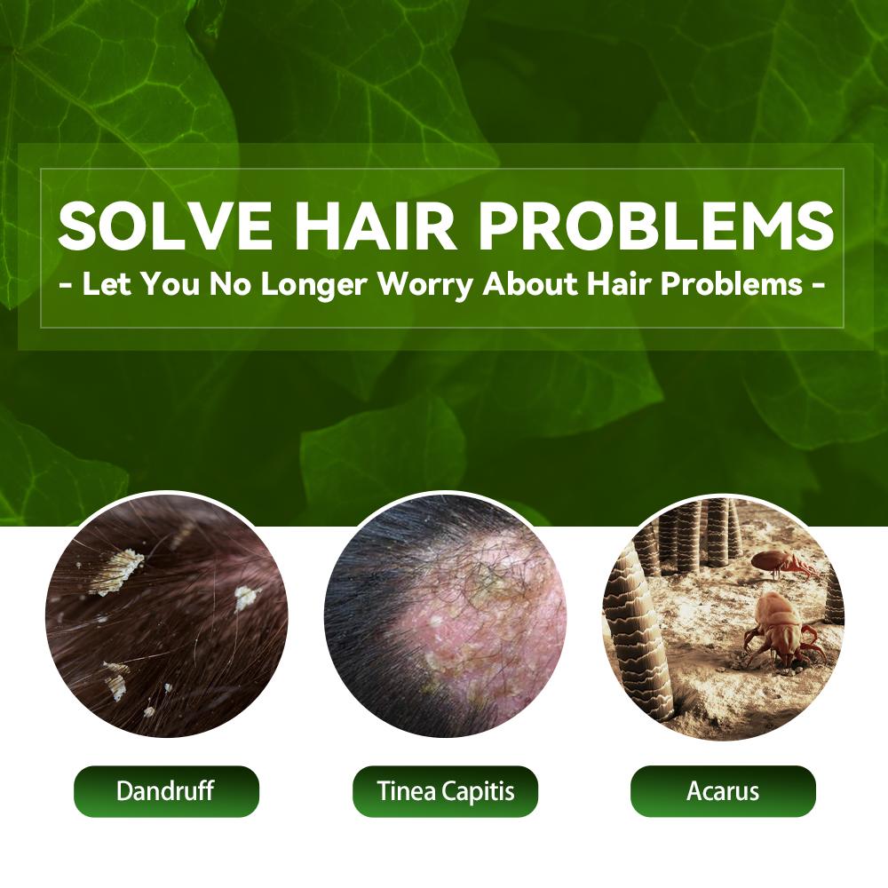 EELHOE Anti Dandruff Shampoo Itch Relief Hair Loss Prevention Oil Control