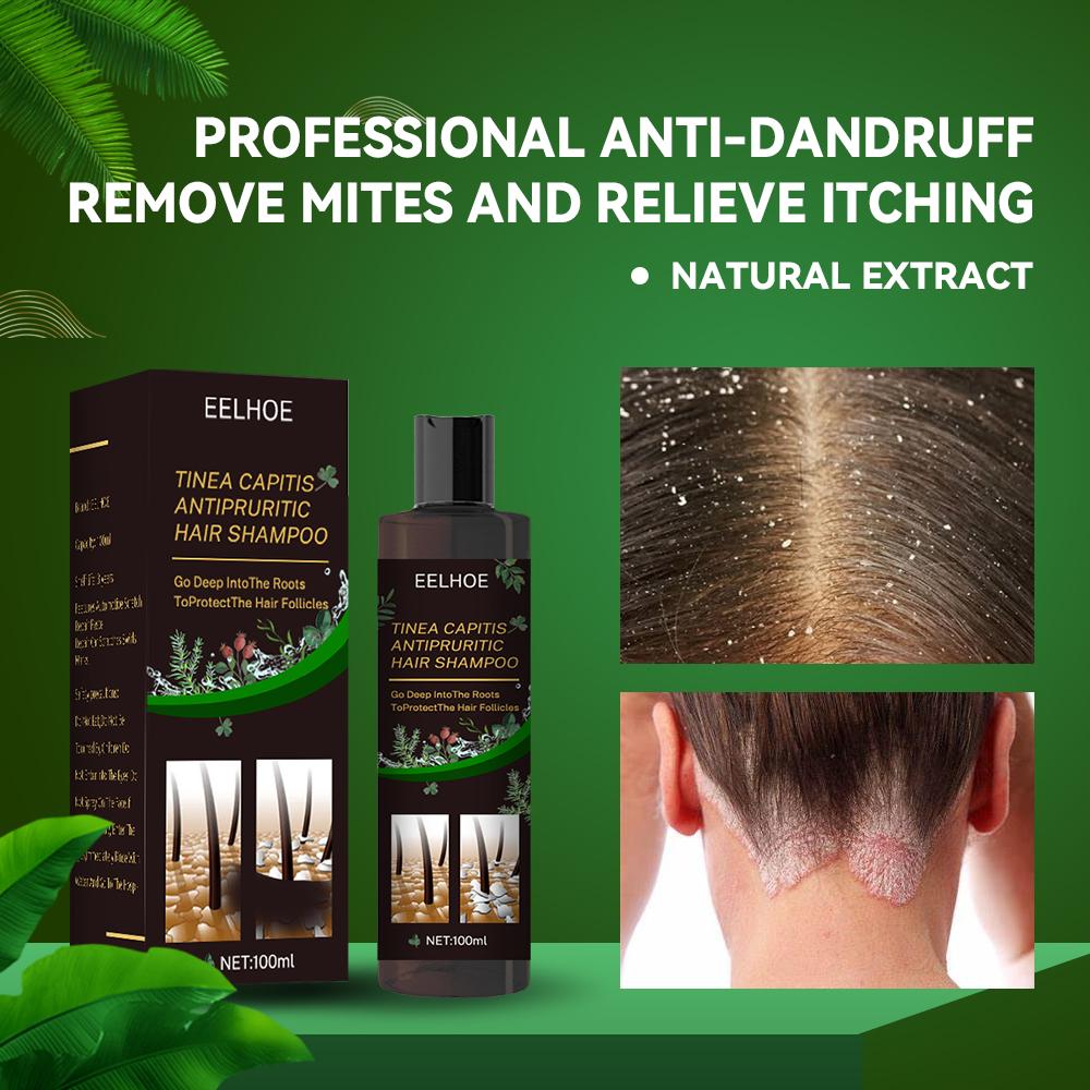 EELHOE Anti Dandruff Shampoo Itch Relief Hair Loss Prevention Oil Control
