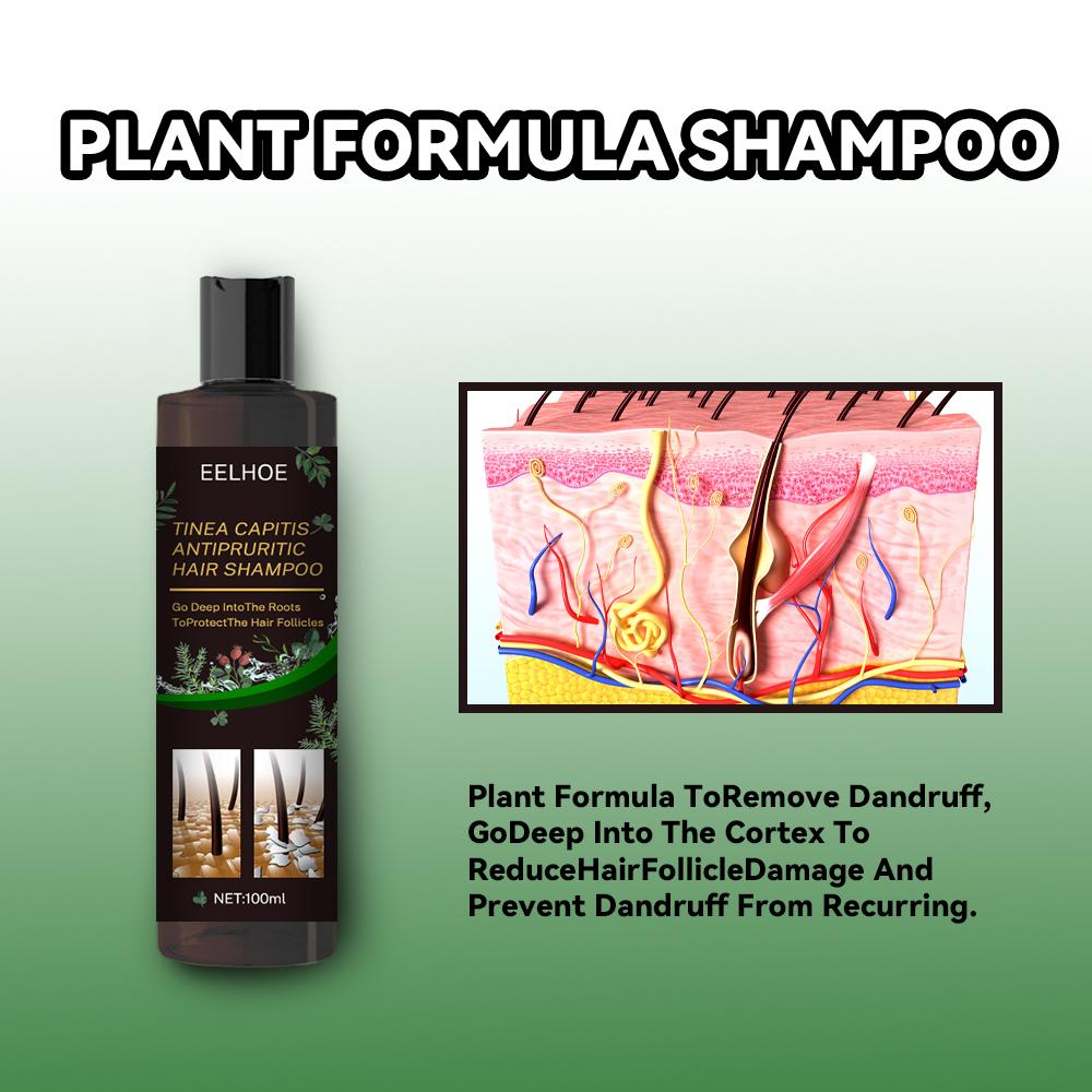 EELHOE Anti Dandruff Shampoo Itch Relief Hair Loss Prevention Oil Control