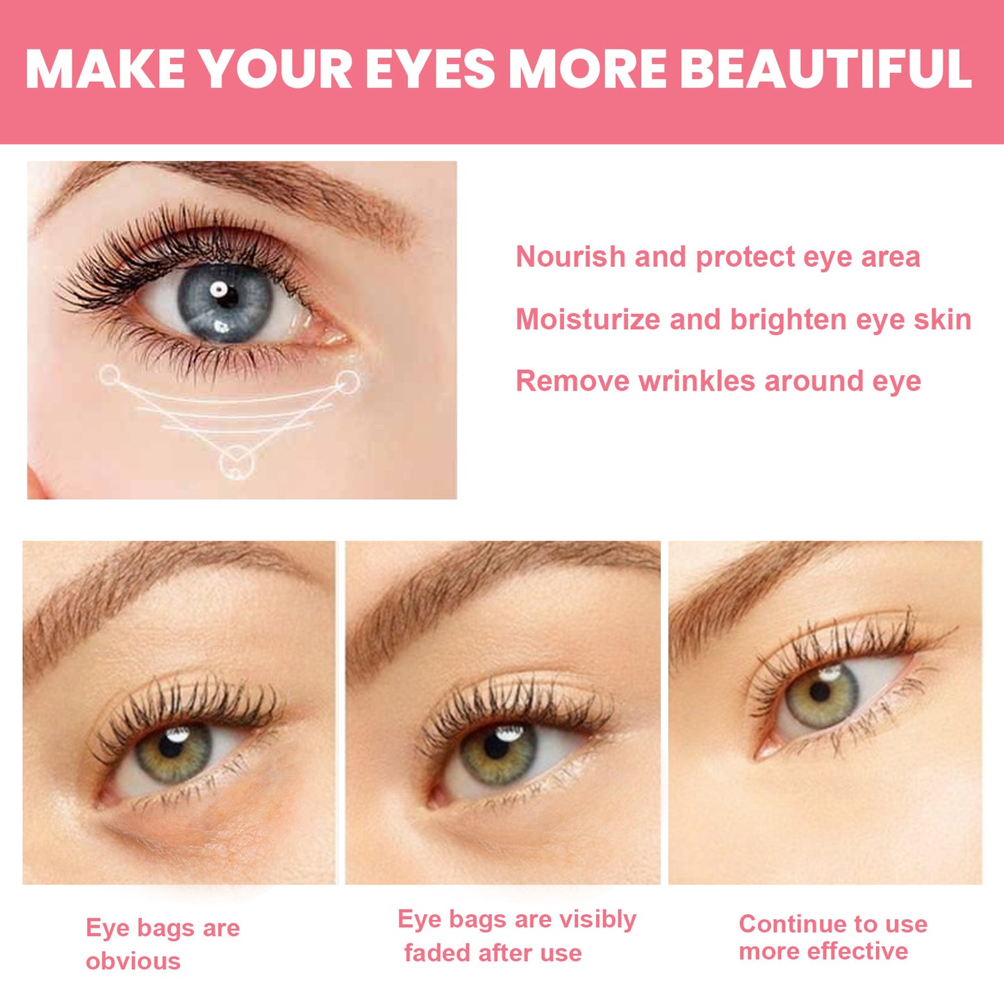 Rosehip Eye Balm Deep Hydration For Lifting And Moisturizing Eye Care